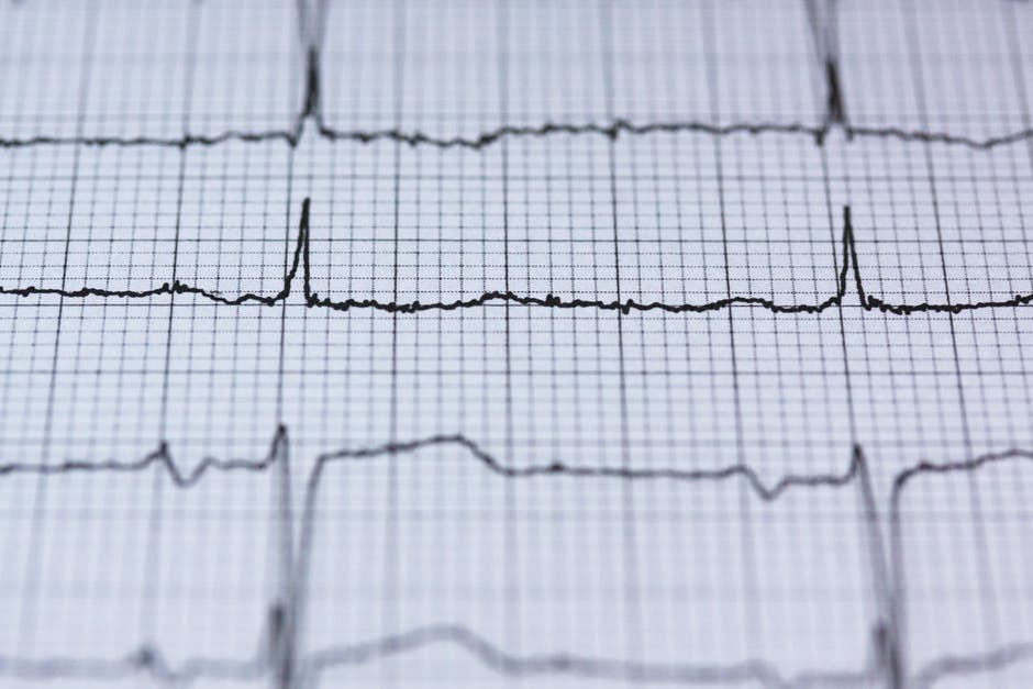 abnormal heart rhythm is a sign of heart disease